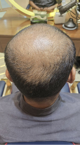 Scalp before and after a MoArae ritual, first result, before