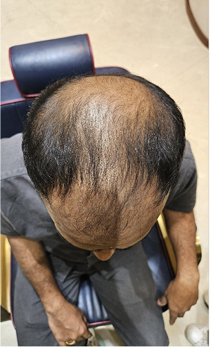 Scalp before and after a MoArae ritual, second result, after